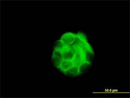 Anti-SGCB Antibody