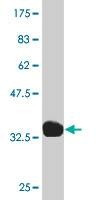 Anti-SGCB Antibody