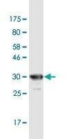 Anti-SGCD Antibody