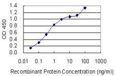 Anti-SGCD Antibody