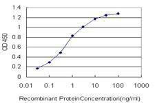 Anti-SGK2 Antibody