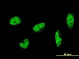 Anti-SH2B Antibody
