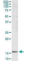 Anti-SH2D1B Antibody
