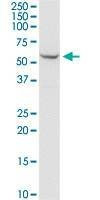 Anti-SHMT2 Antibody