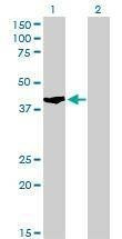 Anti-SHOX2 Antibody