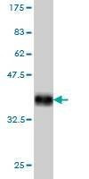 Anti-SHOX2 Antibody