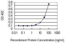 Anti-SHOX2 Antibody
