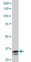 Anti-SHOX2 Antibody