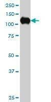 Anti-SIRT1 Antibody