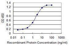 Anti-SKIL Antibody