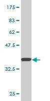 Anti-SLC11A2 Antibody