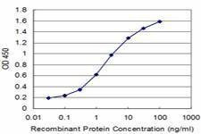 Anti-SLC11A2 Antibody