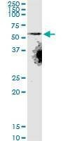 Anti-SLC22A8 Antibody