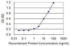 Anti-SLC22A8 Antibody
