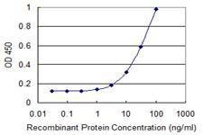 Anti-SLC25A16 Antibody