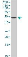 Anti-SLC2A10 Antibody