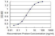 Anti-SLC2A10 Antibody