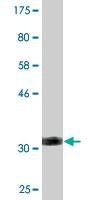 Anti-SLC2A10 Antibody