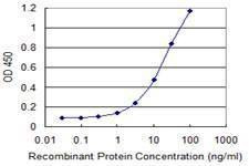 Anti-SLC2A4 Antibody