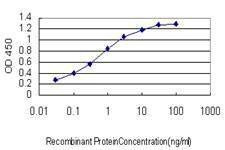 Anti-SLC35A3 Antibody