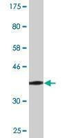 Anti-SLC39A10 Antibody