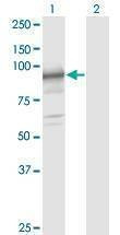 Anti-SLC39A10 Antibody