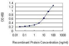 Anti-SLC39A13 Antibody