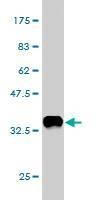 Anti-SLC3A1 Antibody