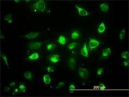 Anti-ACAA2 Antibody