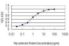 Anti-ACAA2 Antibody