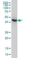 Anti-ACAA2 Antibody