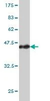 Anti-ACAA2 Antibody