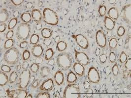 Anti-ACAA2 Antibody