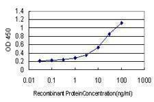 Anti-SLC45A2 Antibody
