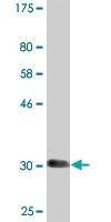 Anti-SLC6A11 Antibody