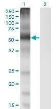 Anti-SLC7A1 Antibody