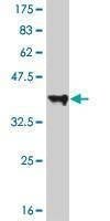 Anti-SLK Antibody