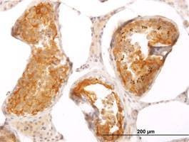 Anti-SLMAP Antibody