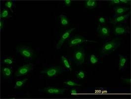 Anti-SMAD5 Antibody