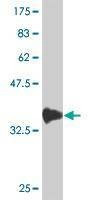 Anti-SMAD6 Antibody