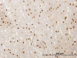 Anti-SMAD6 Antibody