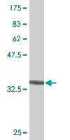 Anti-SMAD7 Antibody