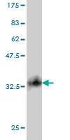 Anti-SMARCD2 Antibody