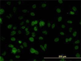Anti-SMARCD2 Antibody