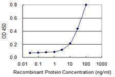 Anti-SMCP Antibody