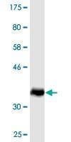 Anti-SMCP Antibody