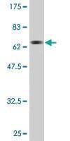 Anti-ACAT2 Antibody