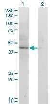 Anti-ACAT2 Antibody