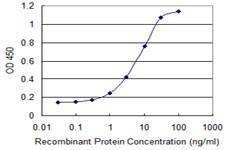 Anti-SMO Antibody