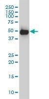 Anti-SMU1 Antibody